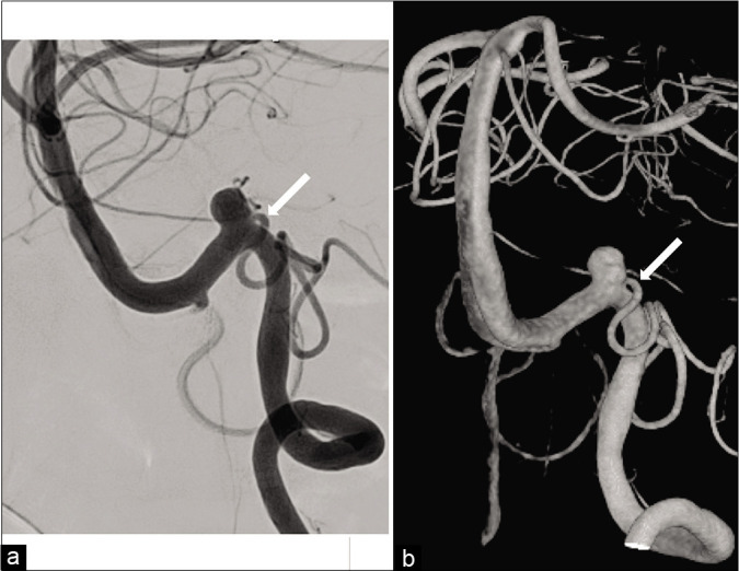 Figure 2: