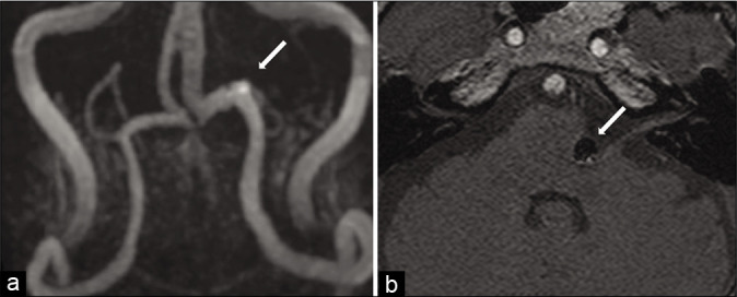 Figure 4: