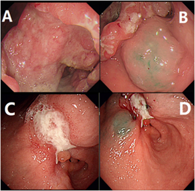 FIGURE 1