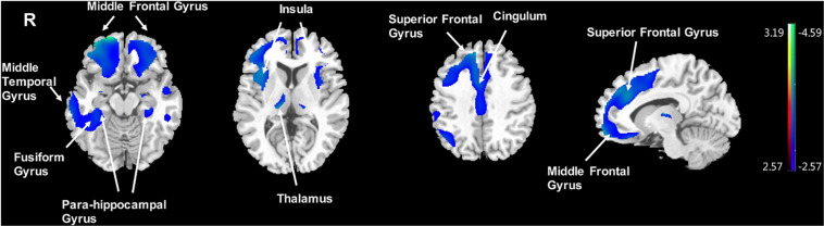 FIGURE 4