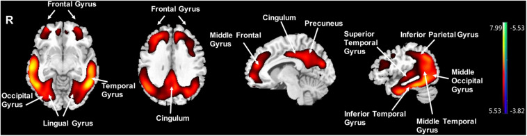 FIGURE 3