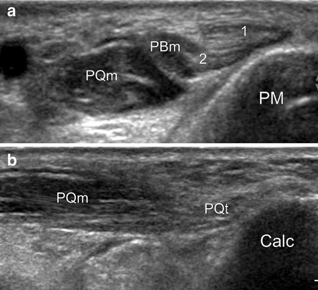 Fig. 6