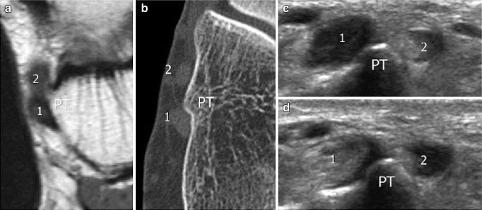 Fig. 5