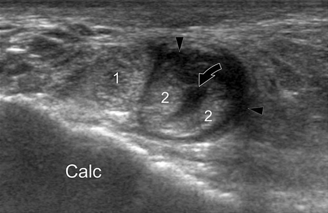 Fig. 10