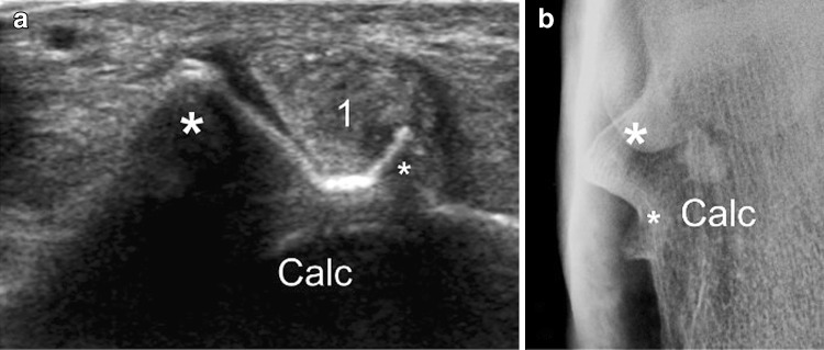 Fig. 8