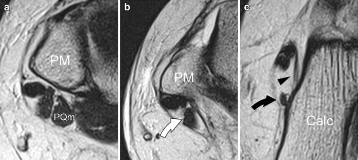 Fig. 7