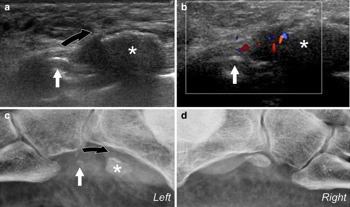 Fig. 13