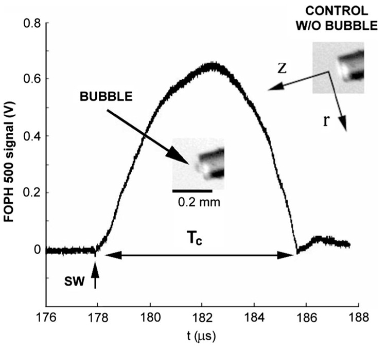 FIG. 11