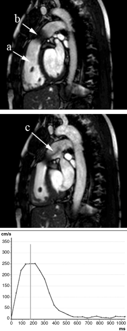 Figure 2)