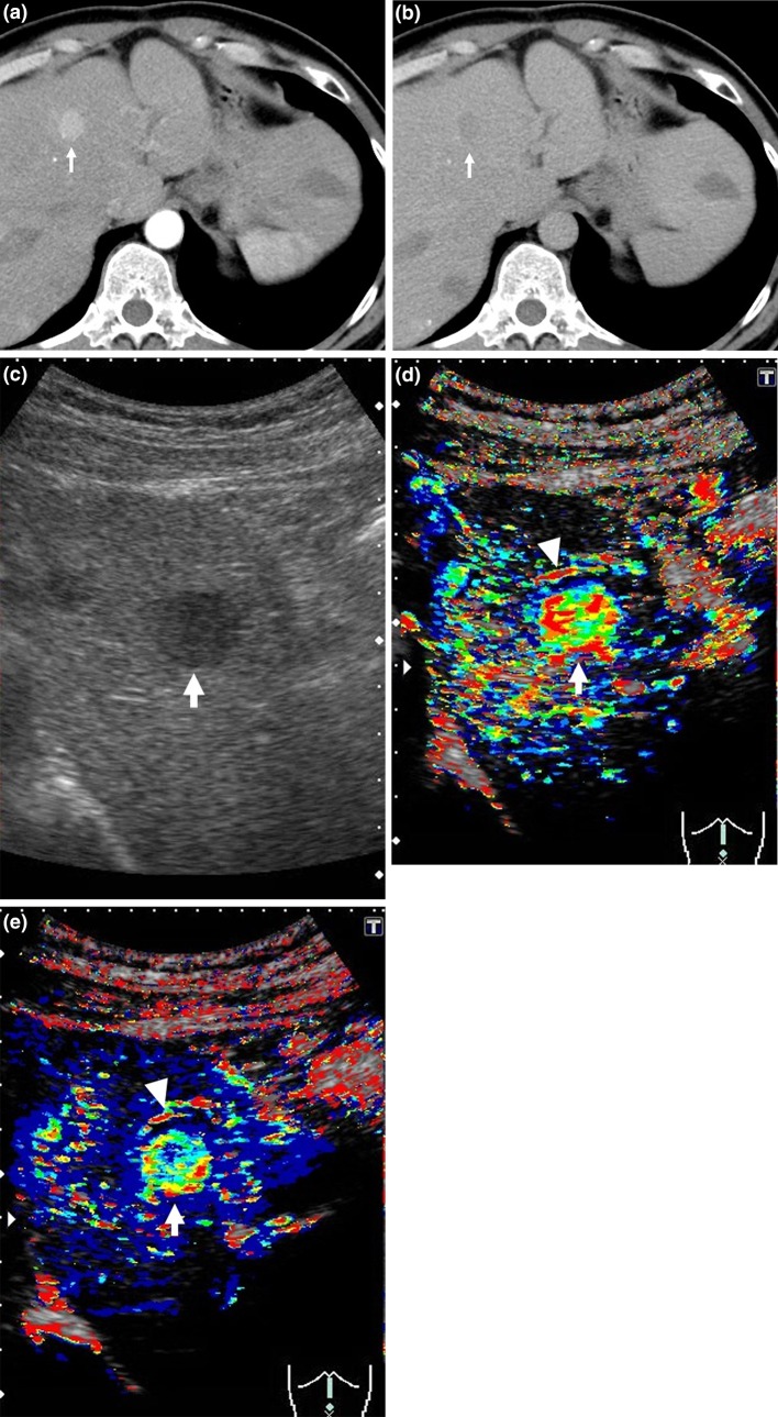 Fig. 2