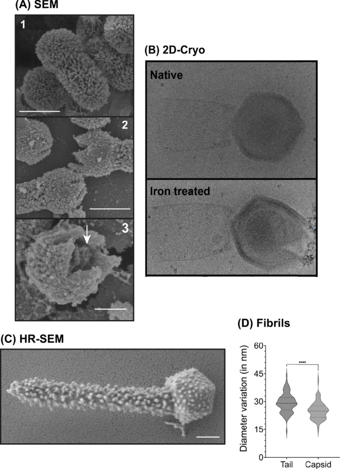 High-resolution SEM and cryo-EM images of Tupanvirus’ detailed morphology, stargate opening and fibril display.