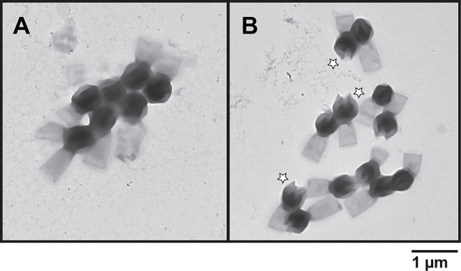 Two TEM images depict Tupanvirus particles. In the top, several closely packed, closed virions are observed, while the bottom highlights distinct particles with the opened stargate marked with white stars for emphasis.