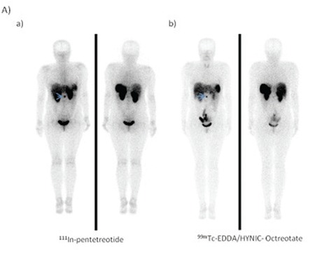 Figure 1-A