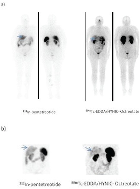 Figure 2A-B