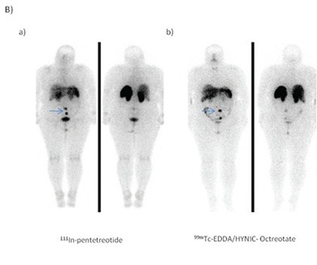 Figure 1-B