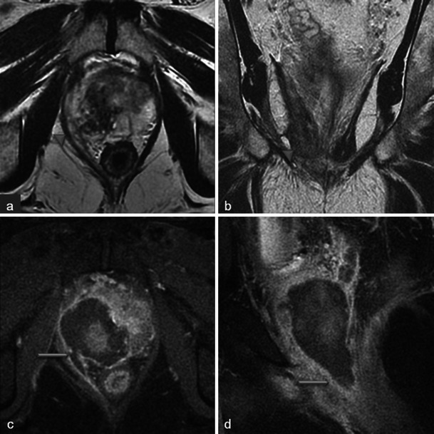 Fig. 21