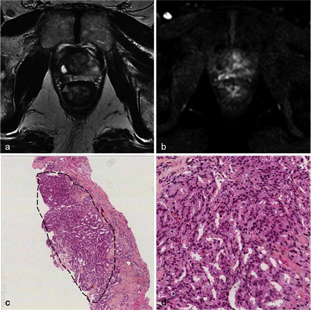 Fig. 28