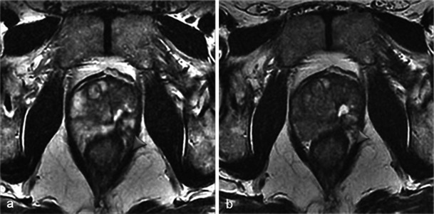 Fig. 15