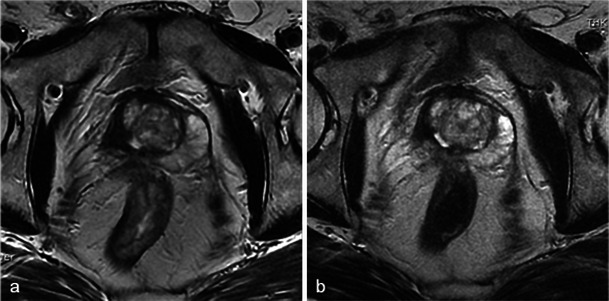 Fig. 16