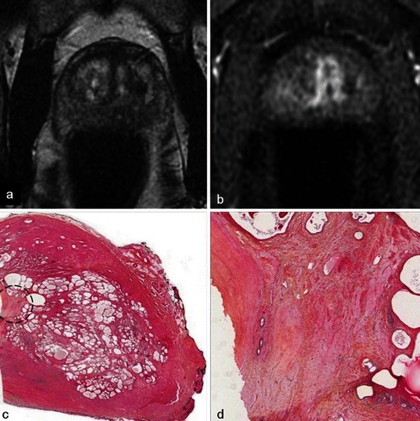 Fig. 12