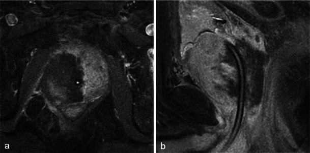 Fig. 26