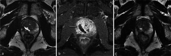 Fig. 18