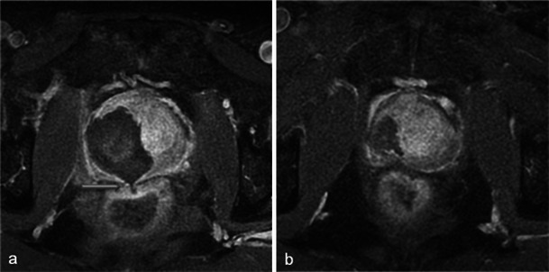 Fig. 24