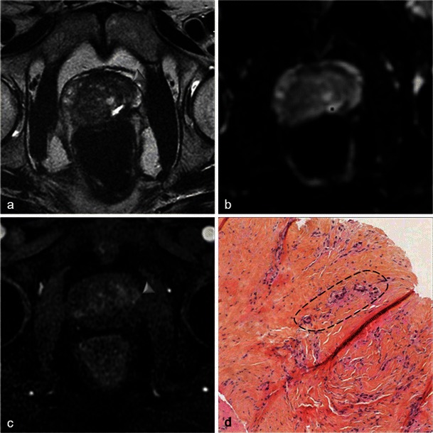 Fig. 29