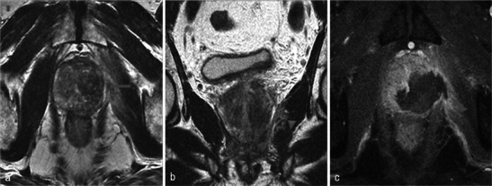 Fig. 23