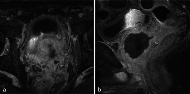 Fig. 25