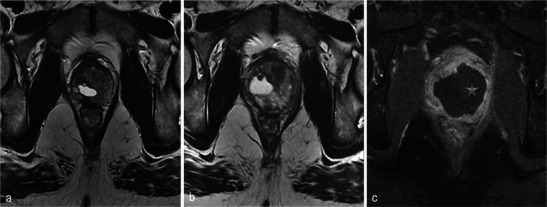 Fig. 19