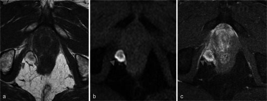 Fig. 20