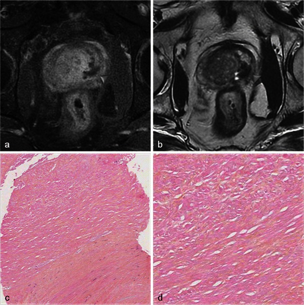 Fig. 11