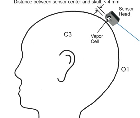 Fig. 3