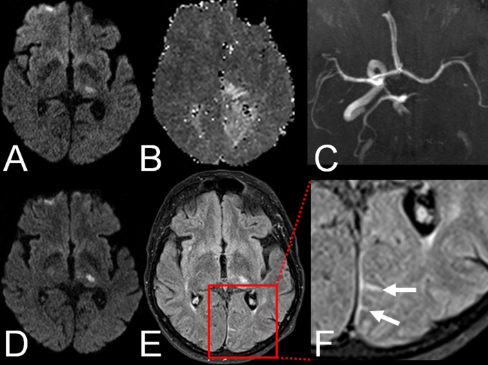 Fig 1