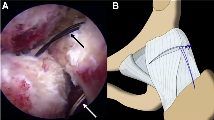 Fig 5