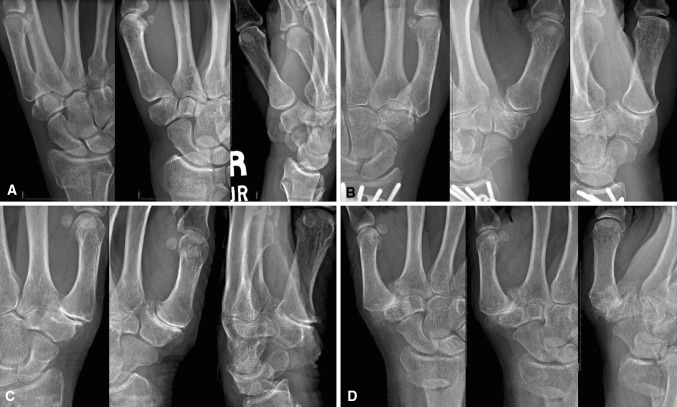 Fig. 2A–D