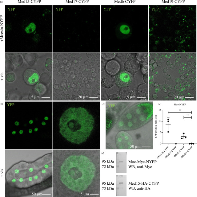 Moesin directly binds Med15 and Med6 in the nucleus in vivo.