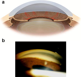 Fig. 4