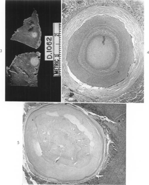 Figs. 3-5