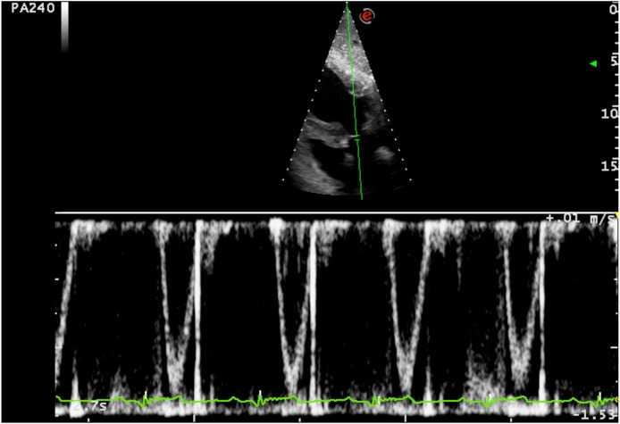 Fig. 2.