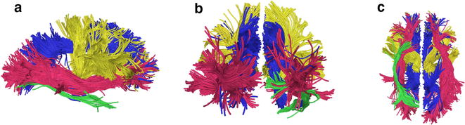 Fig. 1