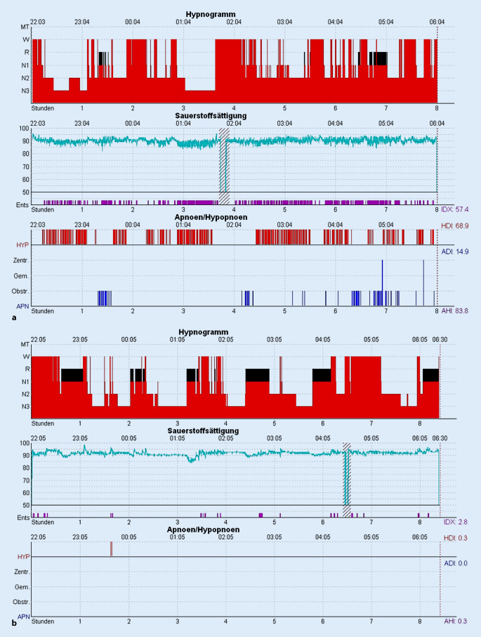 graphic file with name 11818_2023_401_Fig1_HTML.jpg