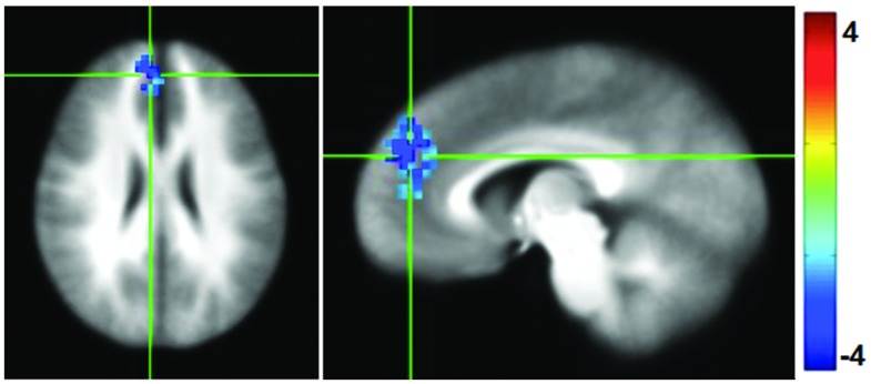 FIGURE 4