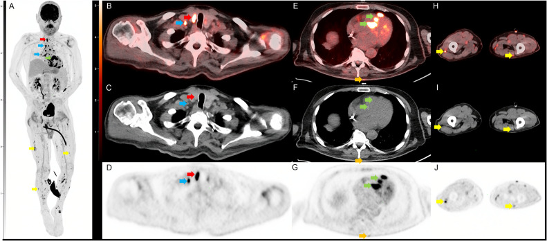 Fig 1