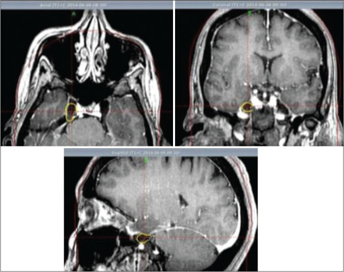 Figure 1: