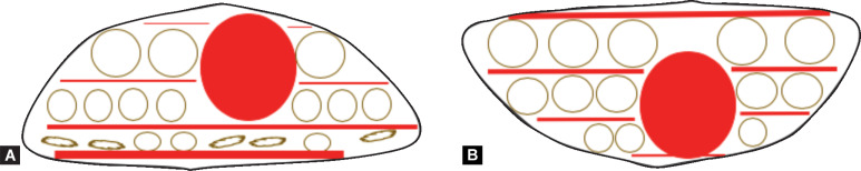 Figs 1A and B