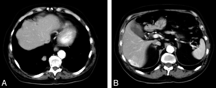 Fig 3.