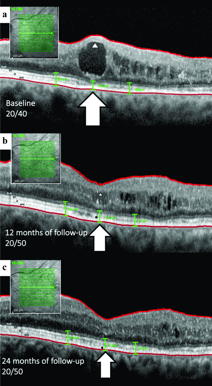 Fig. 3