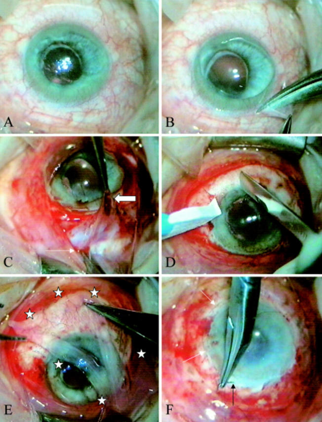 Figure 1  